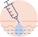 Médecine esthétique - injection de toxine botulique